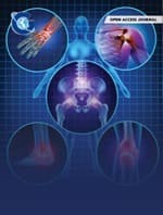 Integrative Transcriptomics Identifies Diagnostic Biomarkers Related to Adenosine Metabolism and Their Molecular Mechanisms in Knee Osteoarthritis